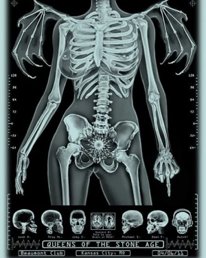 Card image top